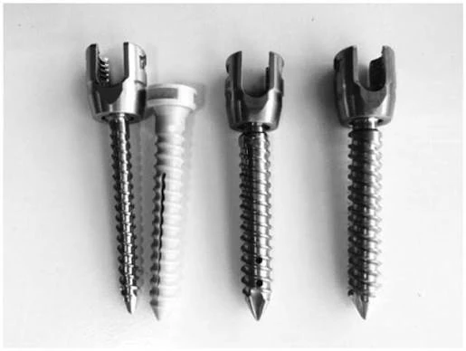 Cannulated Pedicle Screw