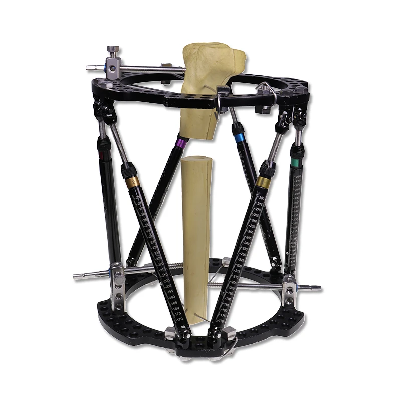 Hexapod External Fixators