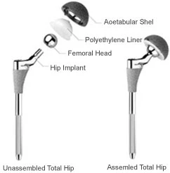 Hip Joint Femoral Heads